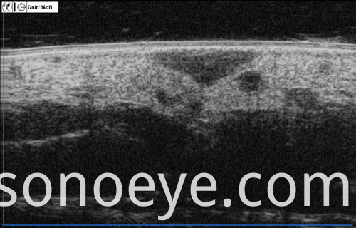 image for Ophthalmic A/B Scanner